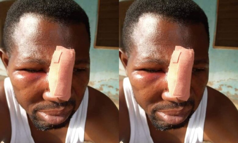 Nungua: JHS Student And His Gang Attack Teacher Over Homework