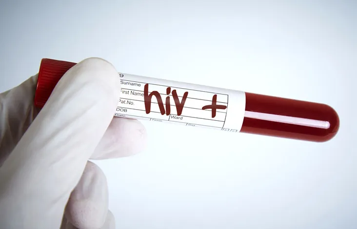 Girl injects herself with boyfriend’s HIV-positive blood “to prove her love”