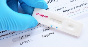 Ghana records 31 new COVID-19 cases