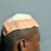 Multimedia journalist sustains life-threatening injuries in police-illegal miners clash